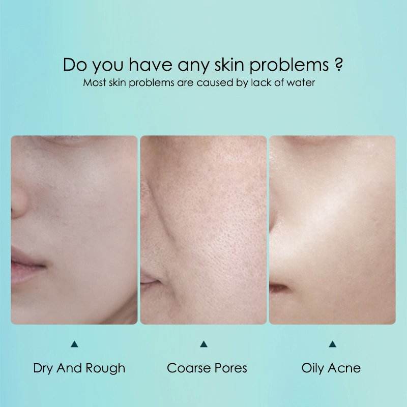 10 pièces acide hyaluronique hydratant masque Facial feuille masques pour visage hydratant rétrécissement Pores hydratant masque