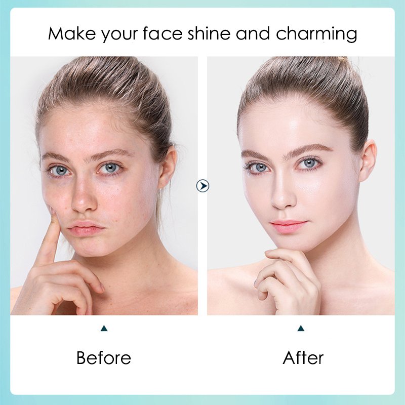 10 pièces acide hyaluronique hydratant masque Facial feuille masques pour visage hydratant rétrécissement Pores hydratant masque