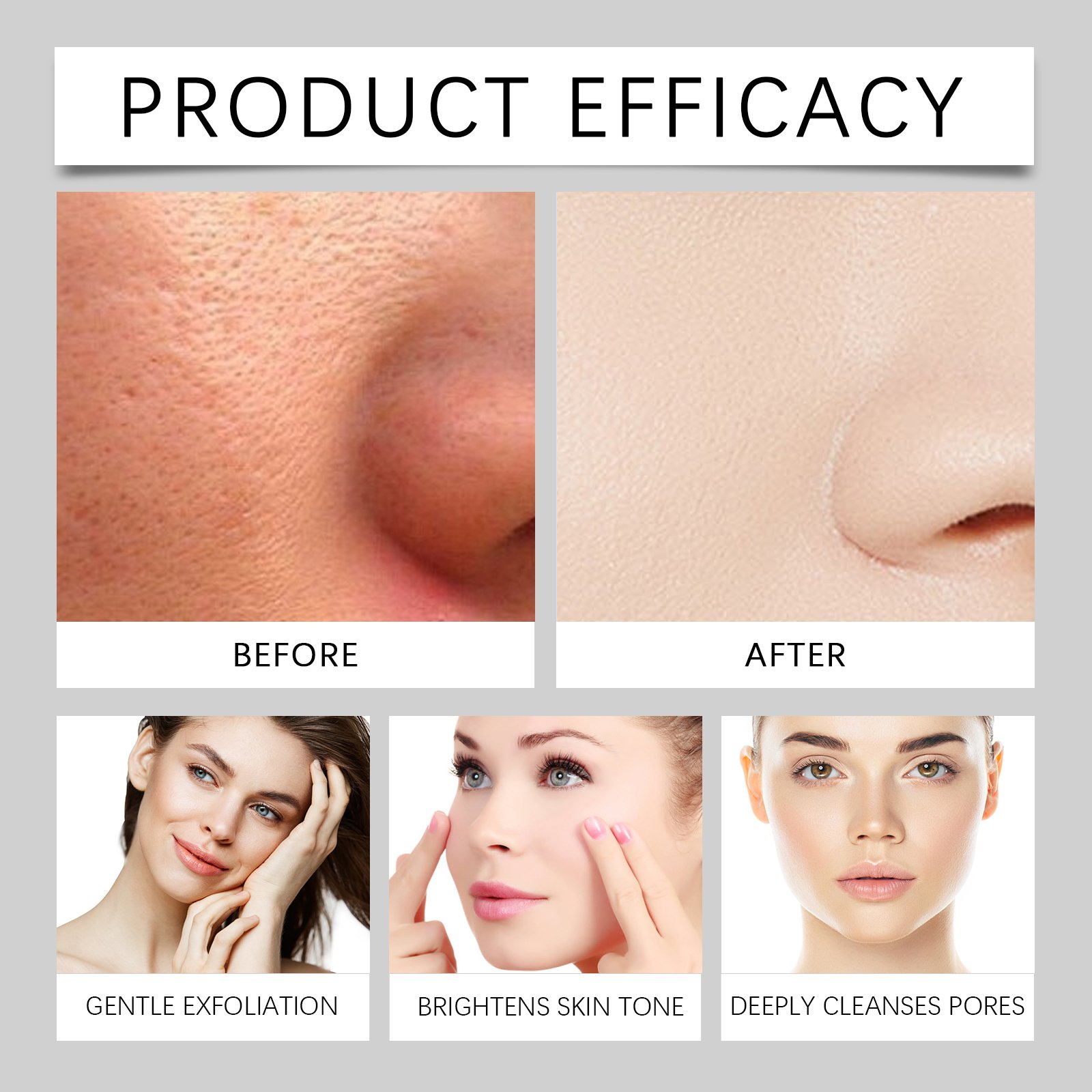 Essence exfoliante de riz noir et blanc, dissolvant de peau morte, réapprovisionnement brillant pour le visage, rétrécissement d