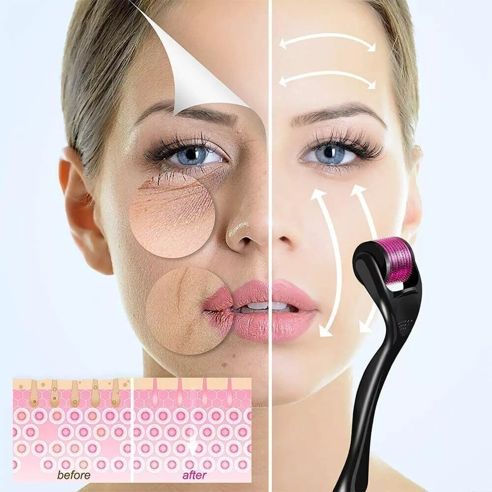 0.2/0.25/0.3mm professionnel 540 Derma rouleau soins de la peau rouleau de Massage outil