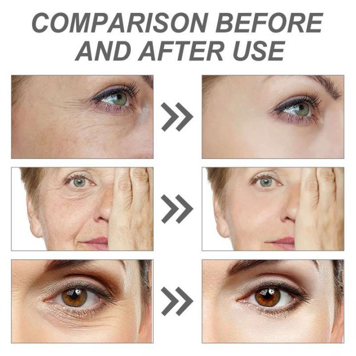 1/2 pièces coréen séoul 1988 rétinol visage sérum estompe les rides fines hydratant blanchissant enlever les taches rétrécisseme