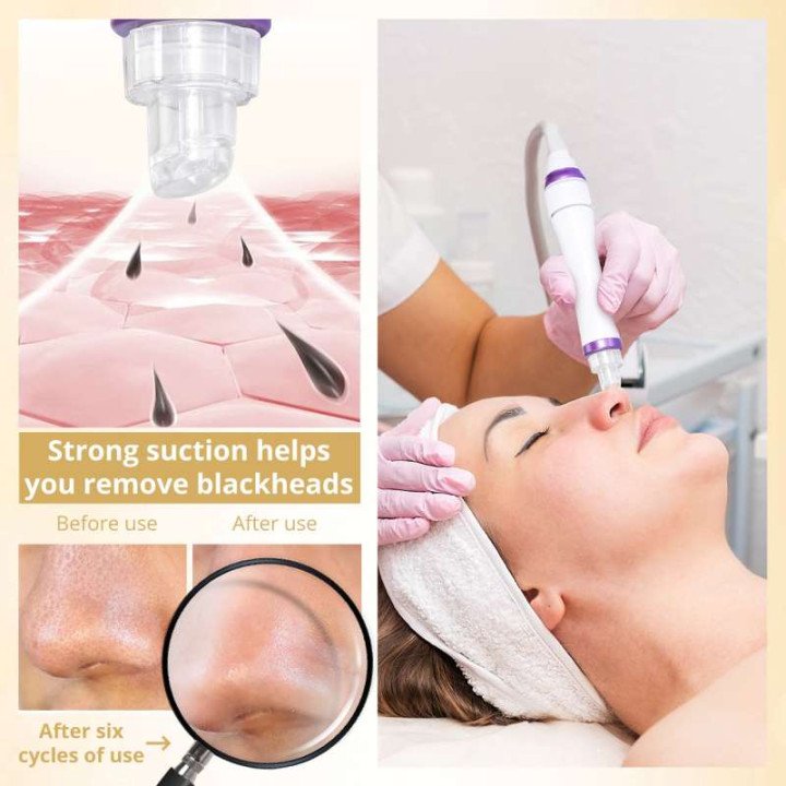 DermDelhi-Machine Hydro-Eau à Oxygène Professionnelle pour Soins de la Peau, Jet Peel Oxy Spray, Livres pour le Visage, Lifting 