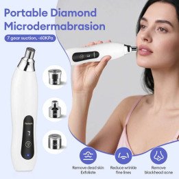 Machine portative d'épluchage du visage de Microdermabrasion de diamant de 3 conseils Exfoliation de diamant nettoyage en profon